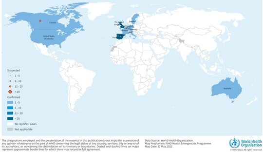 Карта распространения оспы обезьян в мире по данным ВОЗ на 21 мая 2022 года. Источник: сайт ВОЗ